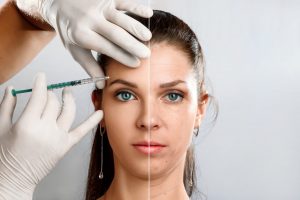 Botox treatments