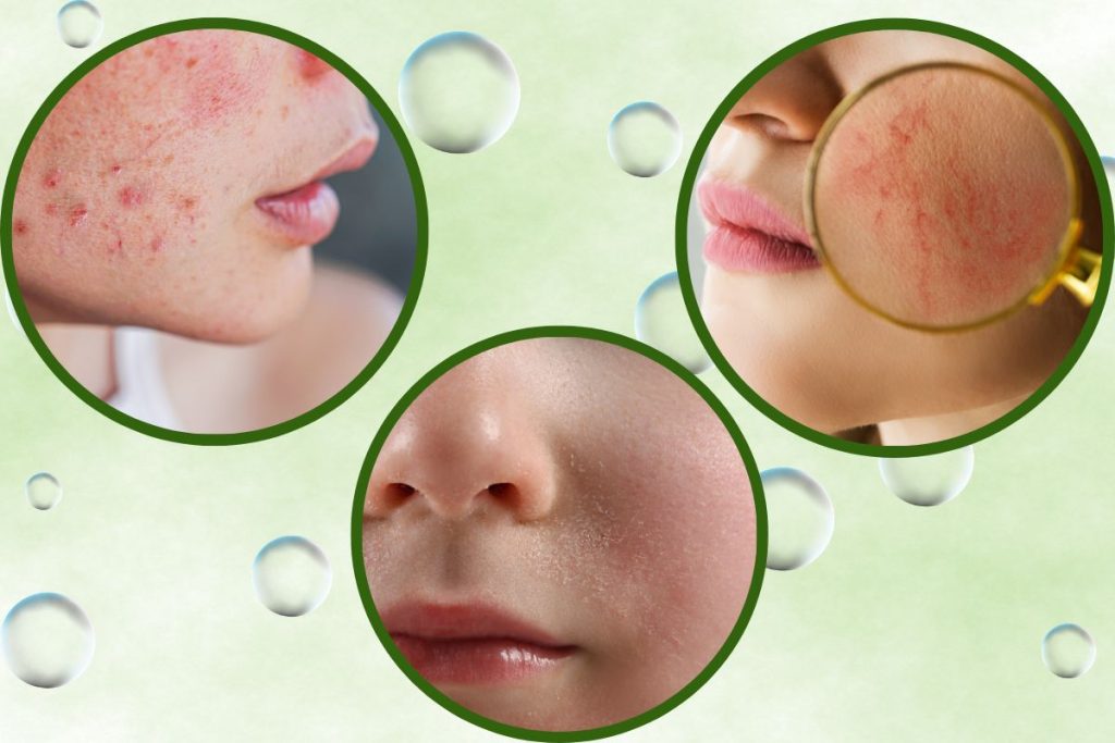 Discover the Benefits of Green Tea Cleansing Masks