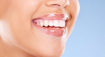 Smiling Elegantly – The Chic Art of Keeping a Brilliant Smile