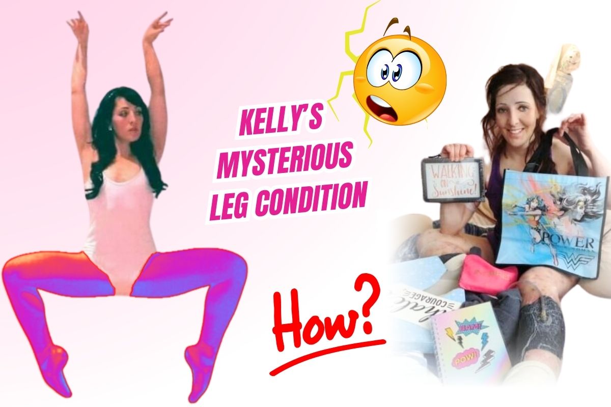What Happened to Kelly Ronahan Legs?
