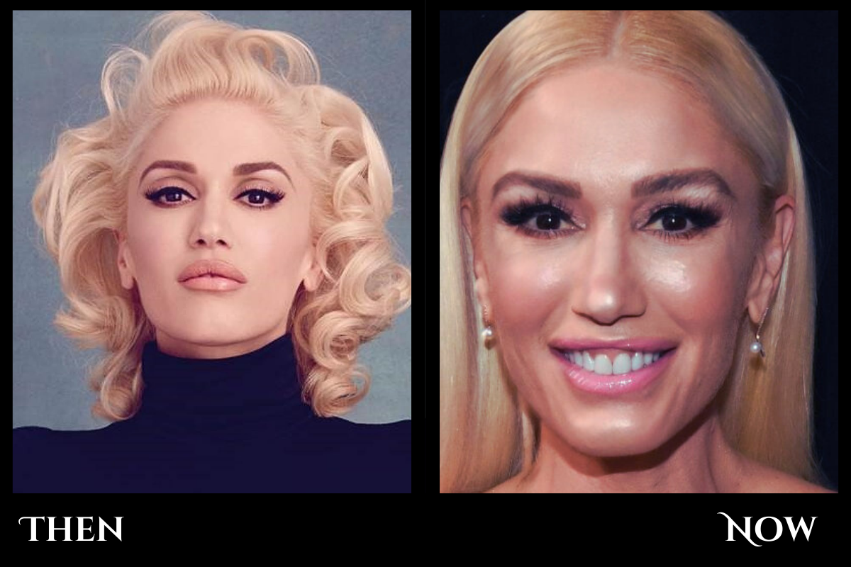 Gwen Stefani Plastic Surgery: The Truth Revealed
