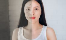 Dermadew Acne Face Wash
